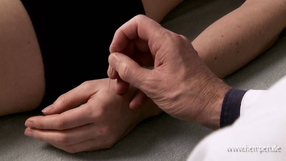  Akupunktur gegen Schmerzen und Beschwerden - Traditionelle Chinesische Medizin TCM in München