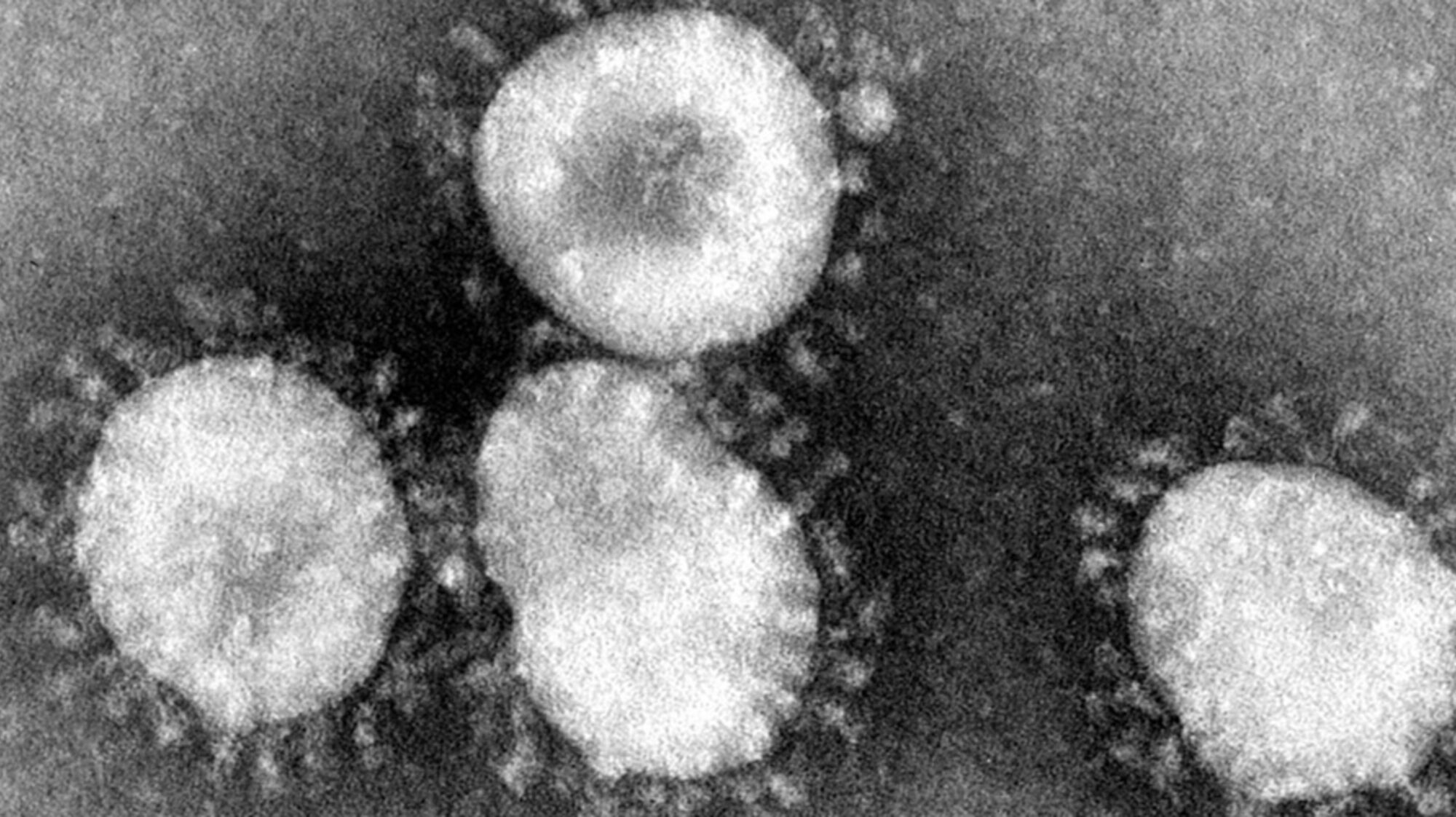 Coronavirus